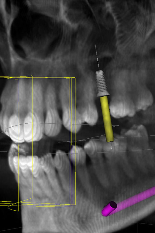 Lubbock Dentist