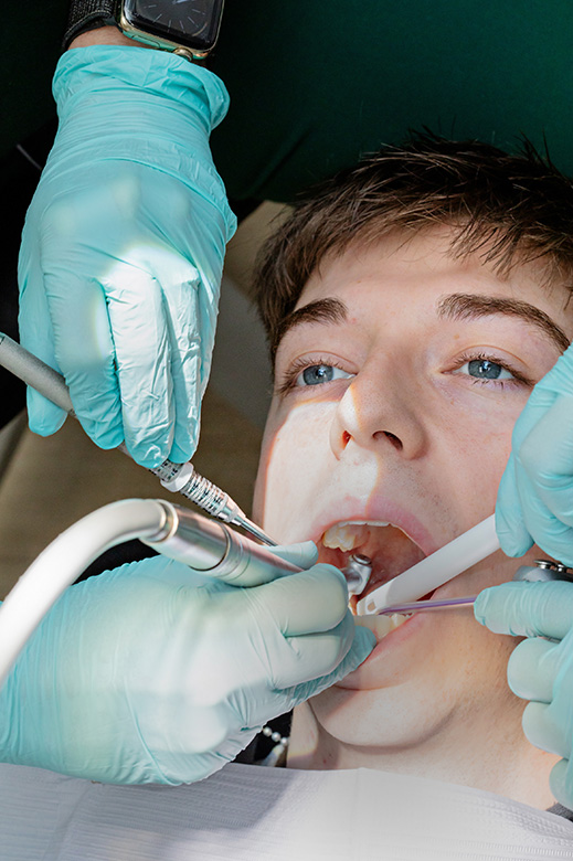 Lubbock Holistic Dentist Cavity Filling Mercury Removal Specialists
